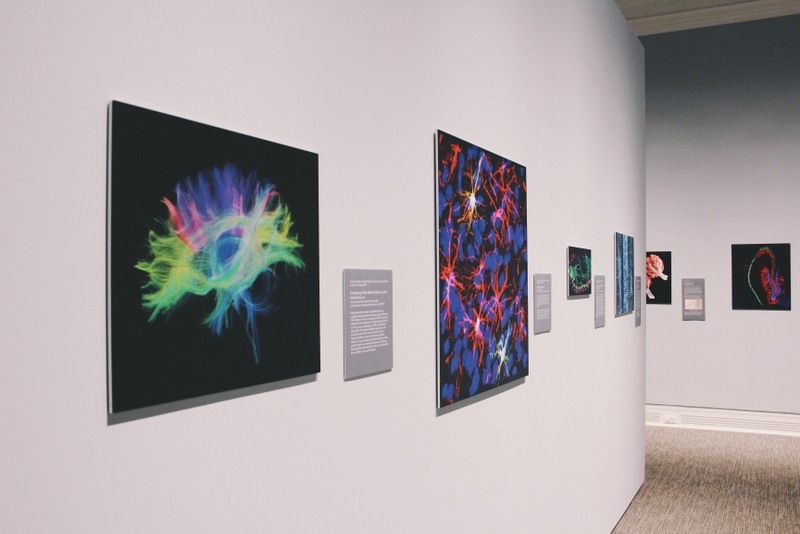 Paintings Attached To A Wall With Brain Studies